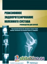 Ревизионное эндопротезирование коленного сустава