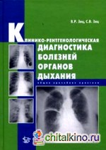 Клинико-рентгенологическая диагностика болезней органов дыхания: Общая врачебная практика