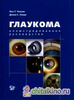 Глаукома: Иллюстрированное руководство