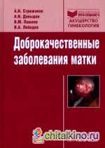 Доброкачественные заболевания матки
