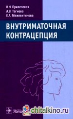 Внутриматочная контрацепция