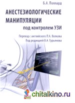 Анестезиологические манипуляции под контролем УЗИ