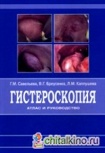 Гистероскопия: Атлас и руководство