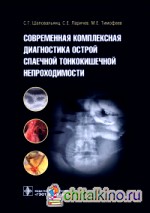 Современная комплексная диагностика острой спаечной тонкокишечной непроходимости