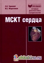 МСКТ сердца