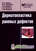 Дерматопластика раневых дефектов: Руководство