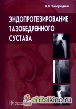Эндопротезирование тазобедренного сустава: Основы и практика. Руководство