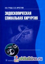 Эндоскопическая спинальная хирургия: Руководство