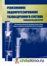 Ревизионное эндопротезирование тазобедренного сустава: Руководство для врачей