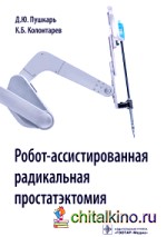Робот-ассистированная радикальная простатэктомия