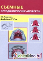 Съемные ортодонтические аппараты