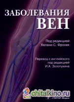Заболевания вен