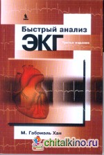 Быстрый анализ ЭКГ