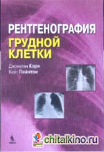 Рентгенография грудной клетки