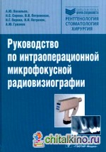 Руководство по интраоперационной микрофокусной радиовизиографии
