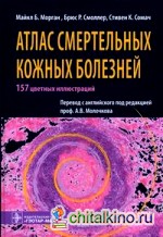 Атлас смертельных кожных болезней