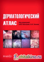 Дерматологический атлас