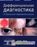 Дифференциальная диагностика в детской дерматологии