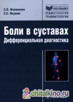 Боли в суставах: дифференциальная диагностика