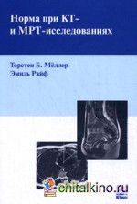 Норма при КТ- и МРТ-исследованиях