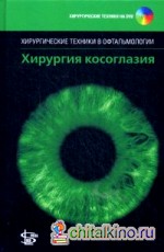 Хирургия косоглазия (+ DVD)