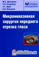 Микроинвазивная хирургия переднего отрезка глаза