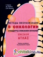 Методы визуализации в онкологи: Стандарты описания опухолей. Цветной атлас