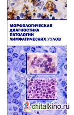 Морфологическая диагностика патологии лимфатических узлов