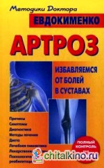 Артроз: Избавляемся от болей в суставах