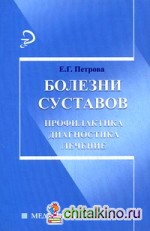 Болезни суставов: Профилактика, диагностика, лечение