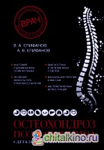 Остеохондроз позвоночника