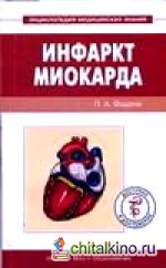 Инфаркт миокарда
