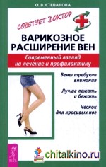 Варикозное расширение вен: Современный взгляд на лечение и профилактику