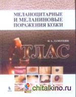 Меланоцитарные и меланиновые поражения кожи: Атлас