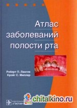 Атлас заболеваний полости рта